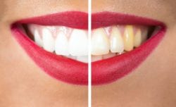 cosmetic dentist in annapolis, maryland