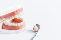 prevent structural dental damage in Annapolis Maryland