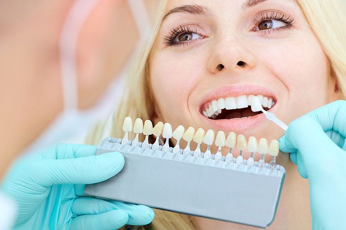 Maximize Benefits from Porcelain Veneers